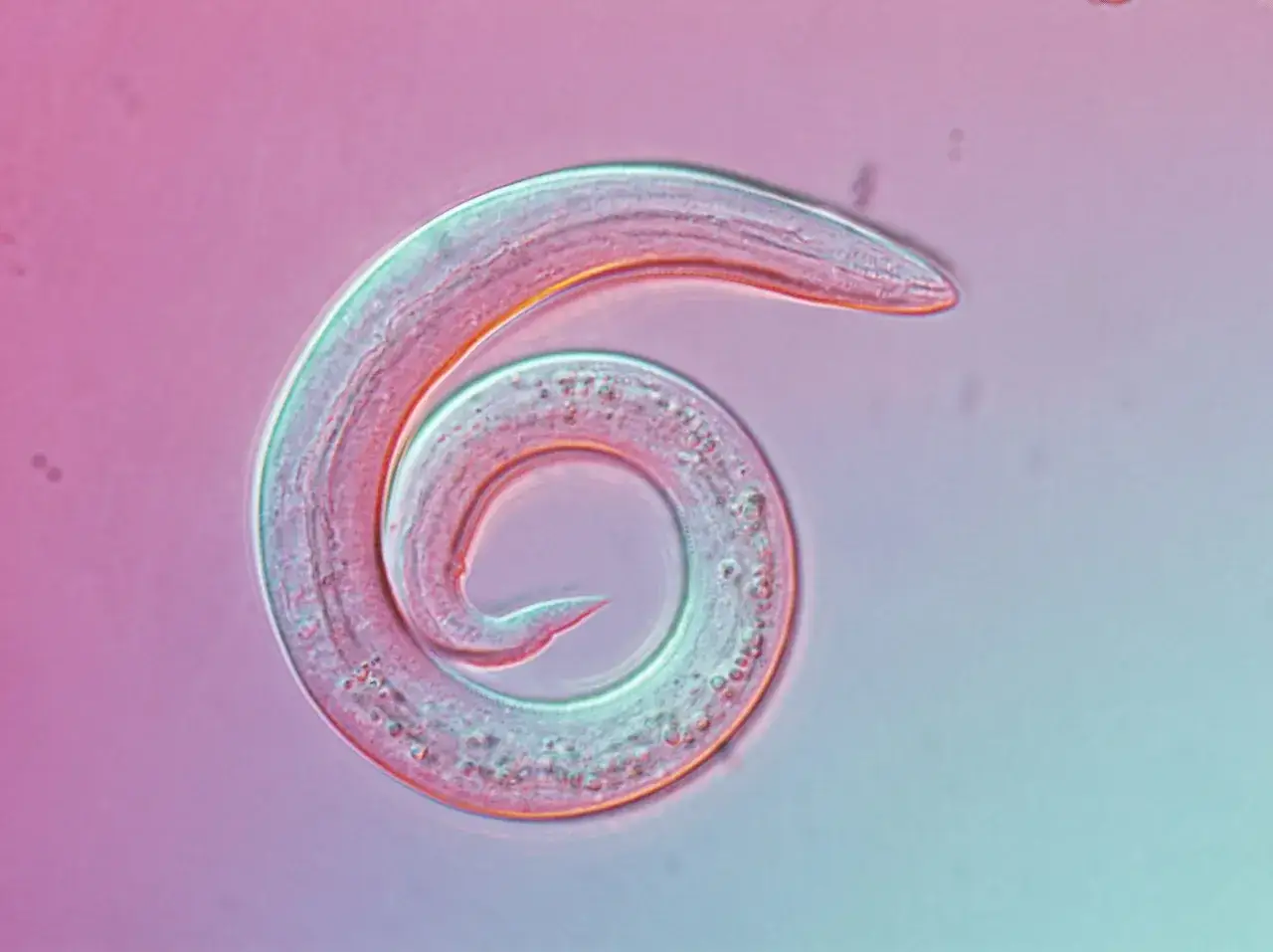 Mikroskopowy obraz nicieni płucnych u kota, zwiniętych w spiralę na tle różowo-niebieskim.